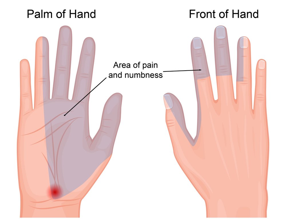 تأثیر مثبت موس ارگونومی روی دست